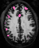 image cerveau buveur