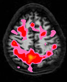 image cerveau non-buveur