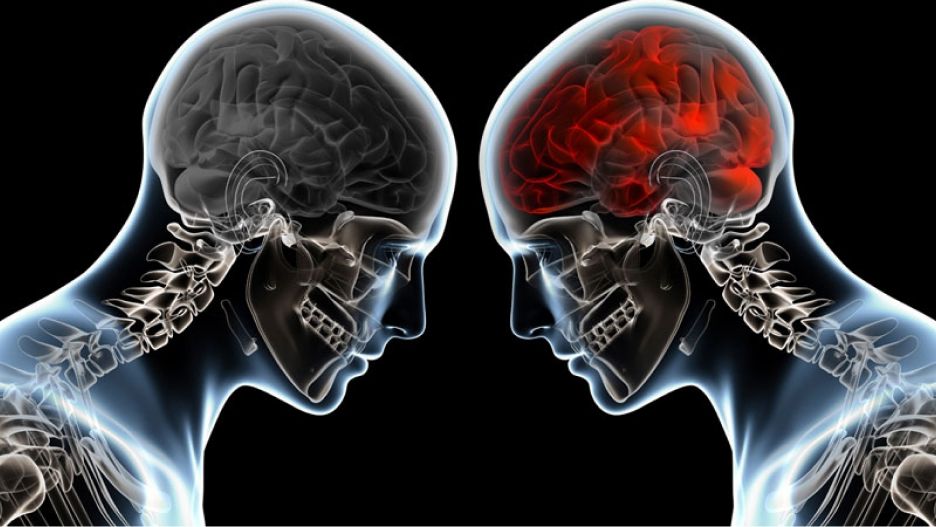 Radiographie de deux hommes en face à face